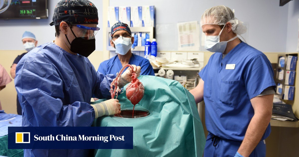 Friends he praises about the Pakistan-born doctor behind the pig-to-human heart transplant